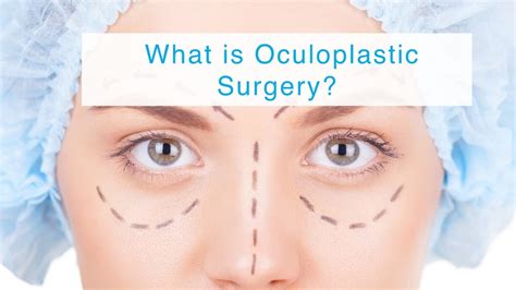 Oculoplastic Surgery The Essentials Doc
